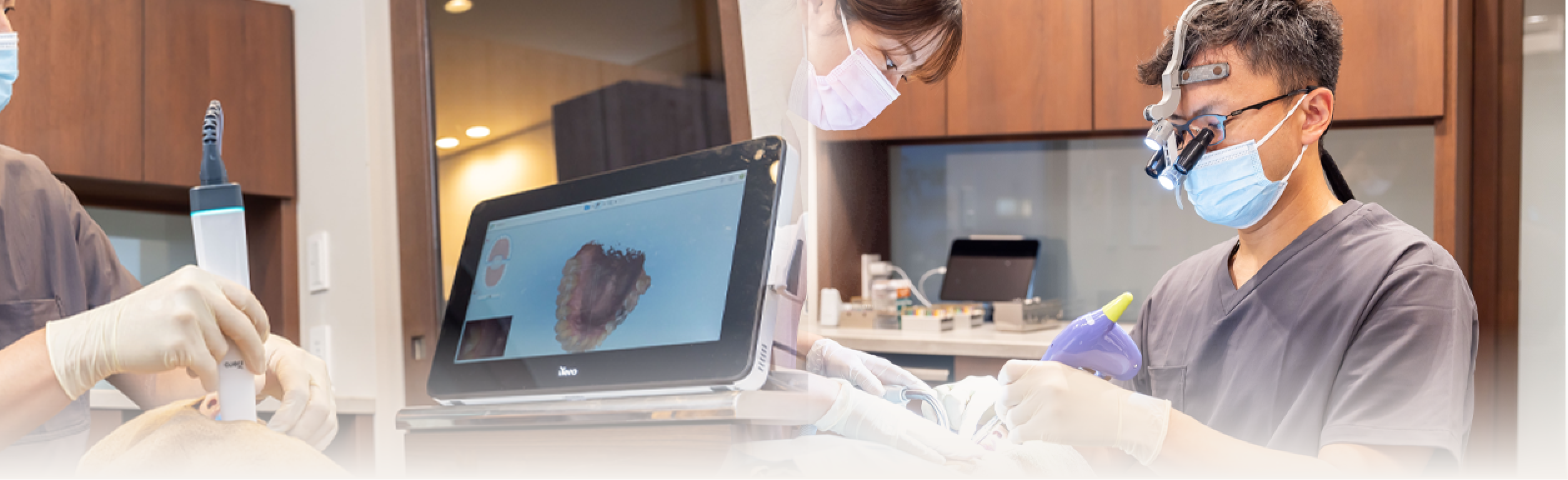 デジタルシミュレーションできる歯科用3DTCや詰め物・被せ物の型取りできる口腔内スキャナーiTero